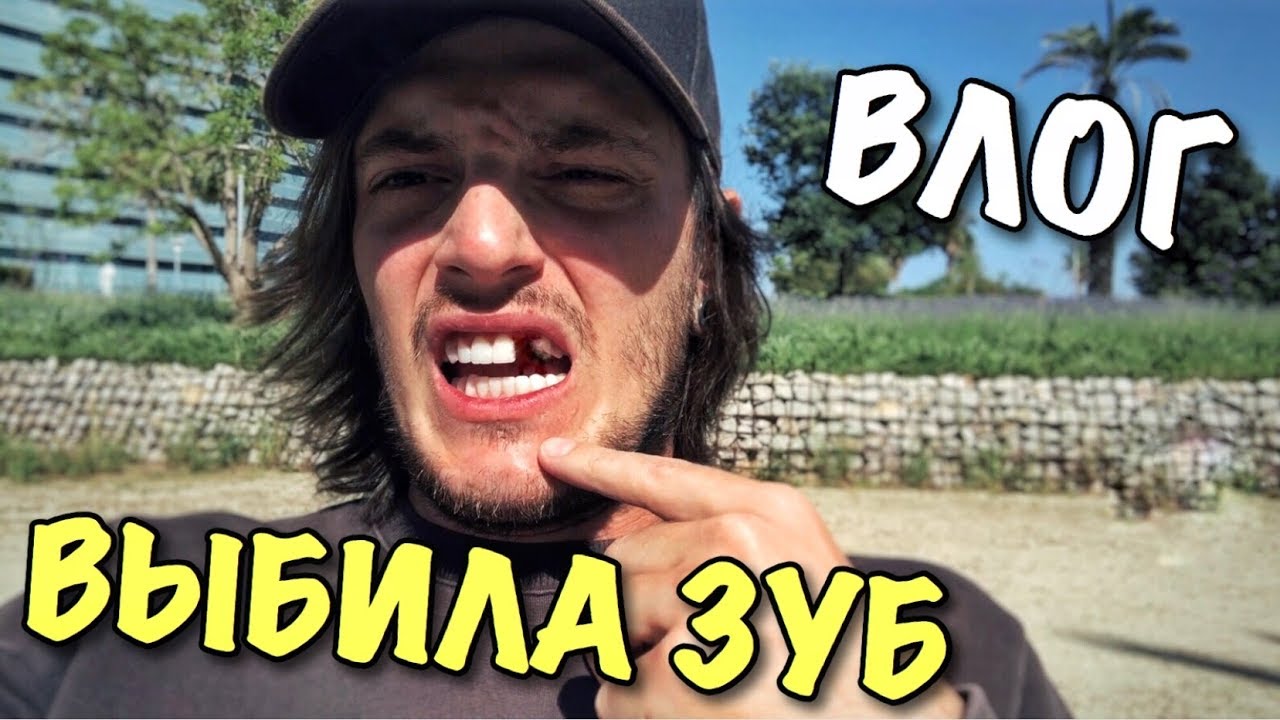 ВЛОГ: ТАНЯ ВЫБИЛА МНЕ ЗУБ!