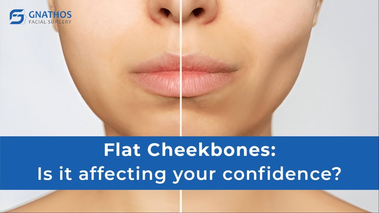 How to Fix Sunken Cheekbones? | Fix Flat Cheekbone | Gnathos Facial
