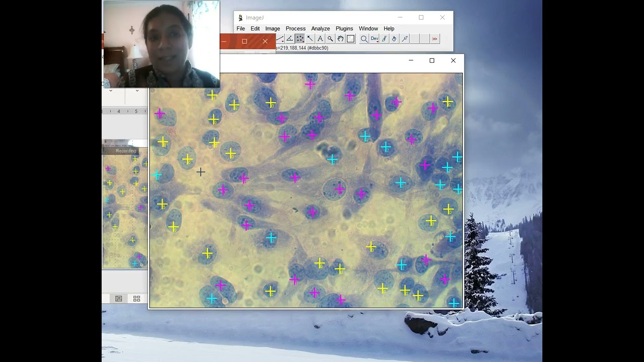 Mprphology analysis using Image J