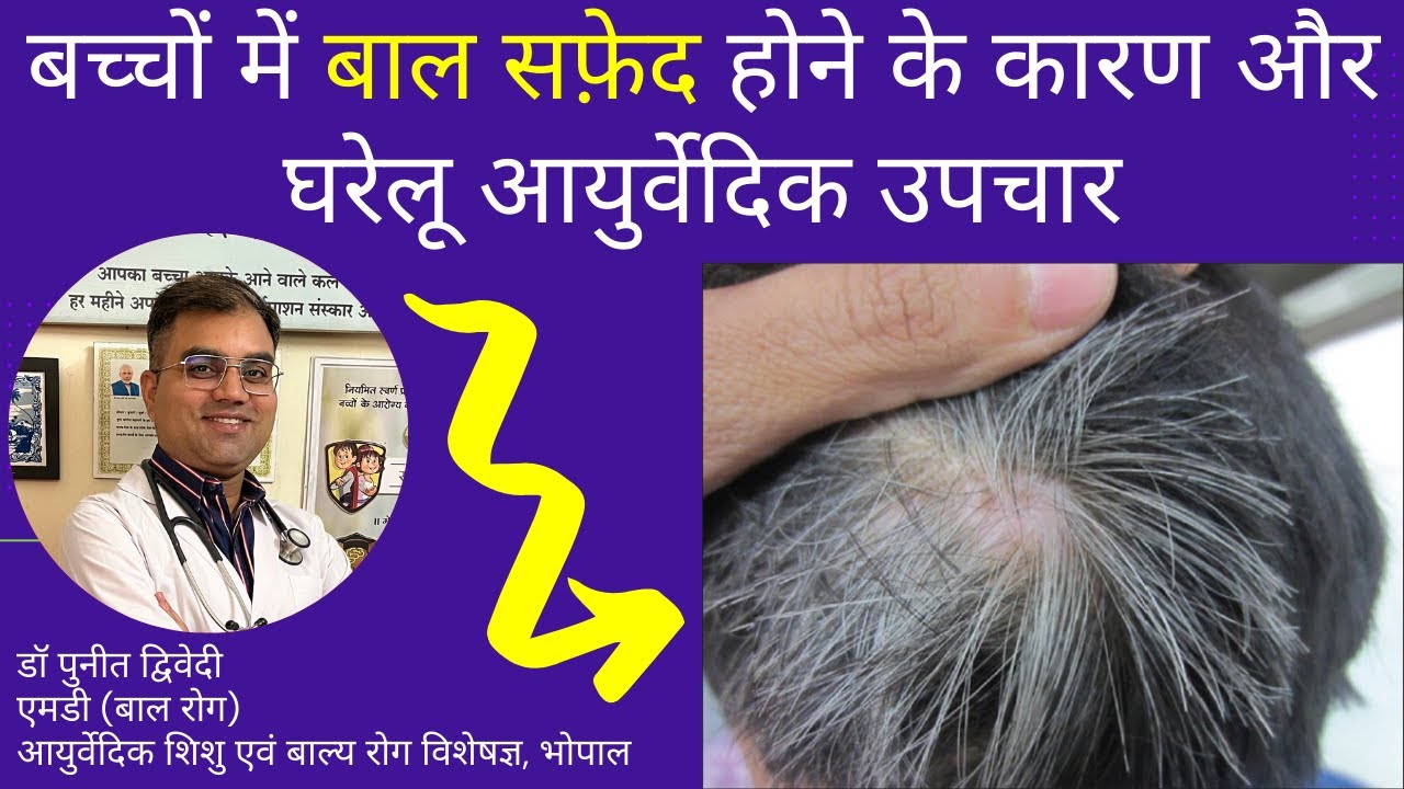 Causes of gray hair in children and home remedies for it | Dr. Puneet Dwivedi
