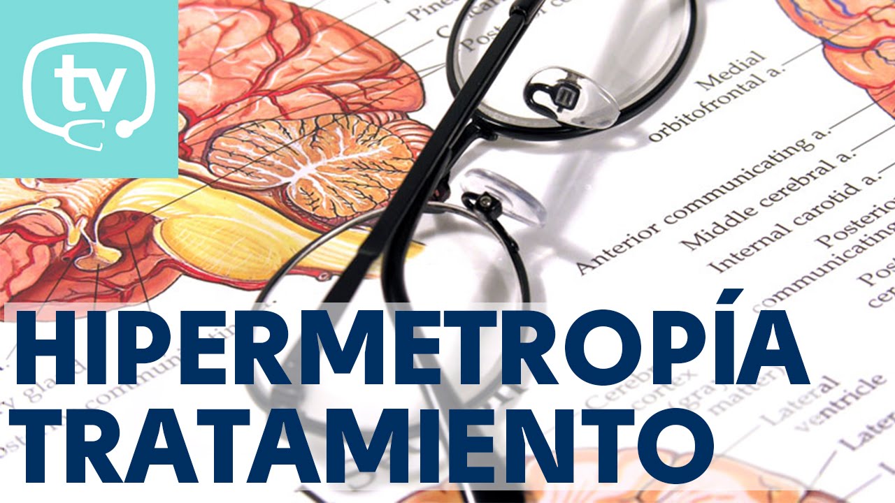 ¿Cómo se corrige la hipermetropía?