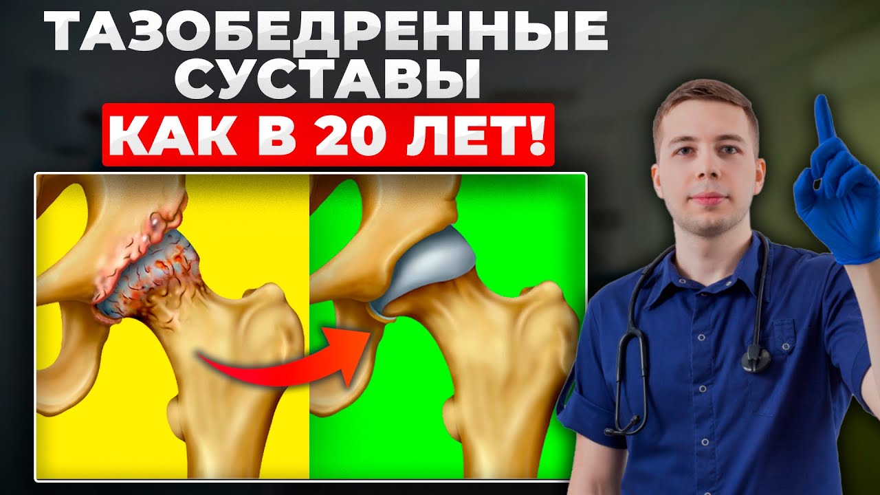Главный СЕКРЕТ лечения коксартроза БЕЗ ОПЕРАЦИИ! ПРОСТОЙ способ лечения тазобедренного сустава...