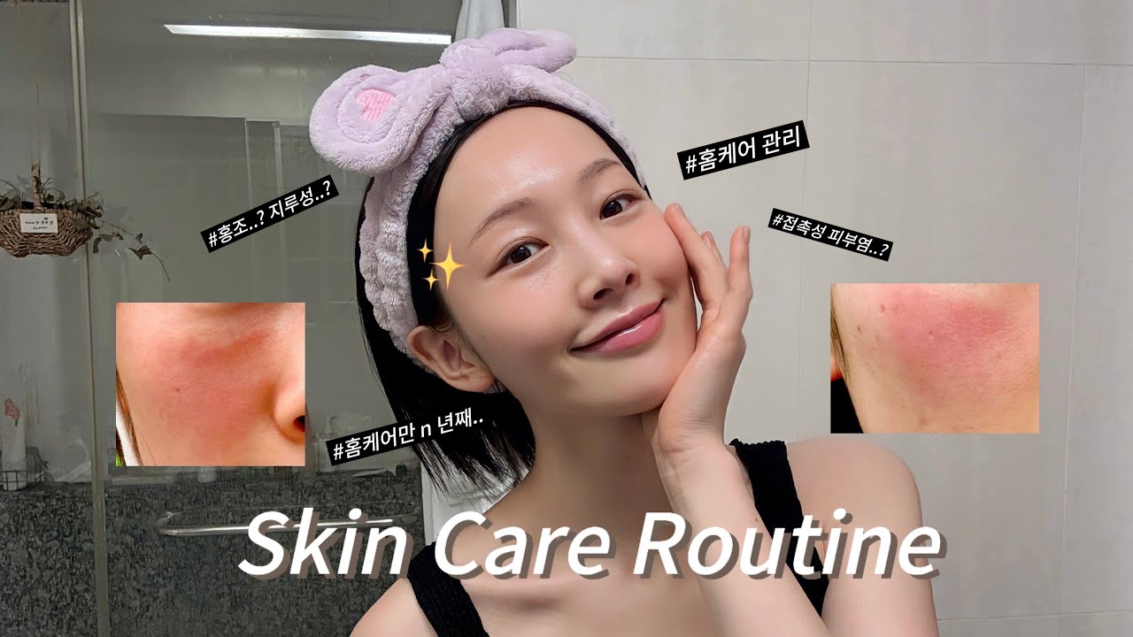 (광고❌) ✨홍조&지루성&접촉성 피부염 홈 케어로 관리하기 | 홈 케어로 피부 좋아지는 방법 | 스킨케어 루틴| 겨울철 피부 관리✨