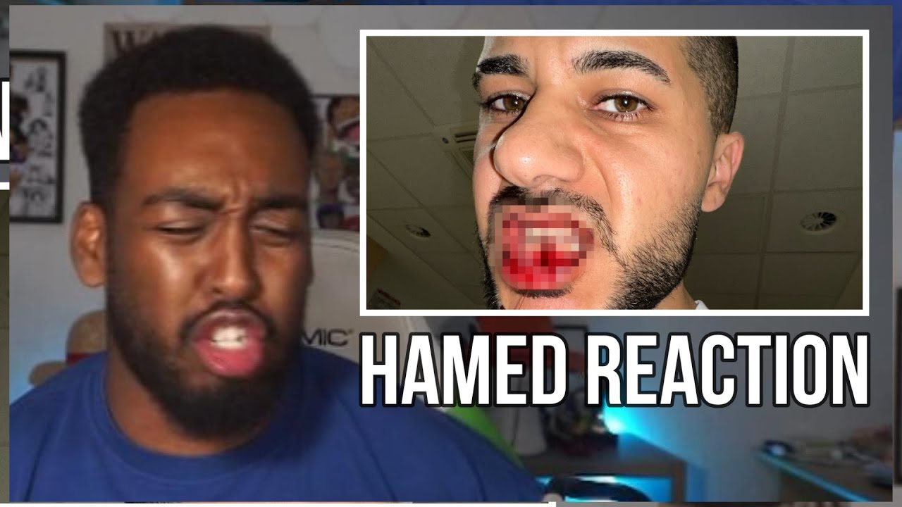 FARO REAGIERT auf HAMED KIEFER GEBROCHEN❤‍🩹😭