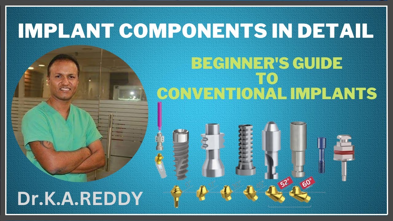 TWO PIECE IMPLANT COMPONENTS | BEGINNERS GUIDE TO CONVENTIONAL IMPLANTS | by Dr K.A.REDDY #