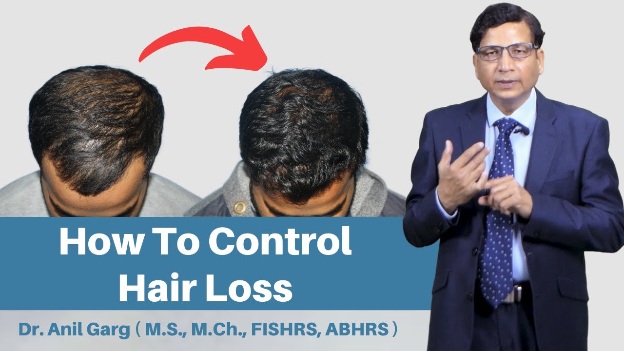 5 Tips on How To Stop Hair Loss And Regrow Hair Naturally? | How To Control Hair Loss & Solution