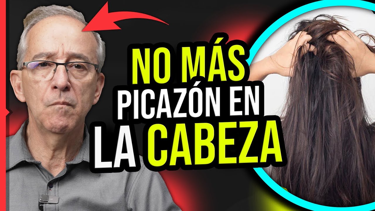 🔴 ME PICA LA CABEZA, Sintomas Y Como Quitarlo - Oswaldo Restrepo RSC