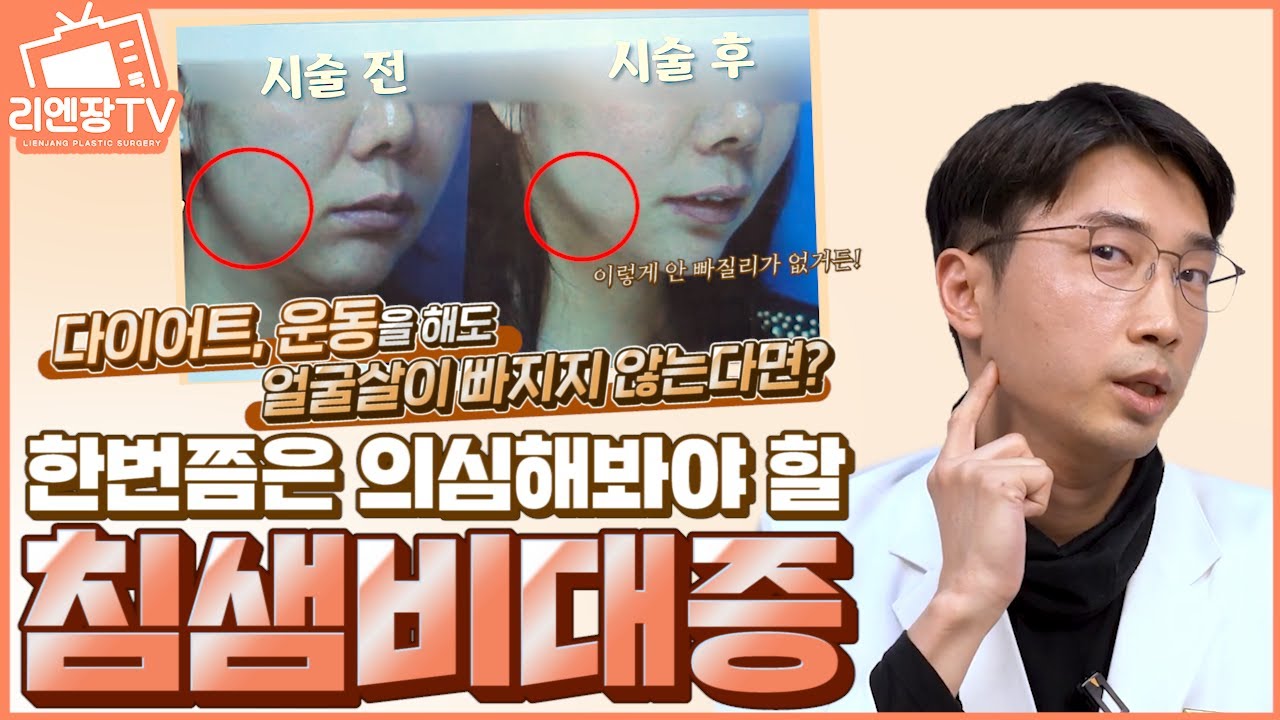 [침샘보톡스] 귀밑, 턱밑 아래 올라와 보이는 살들,  이게 살이 아닐 수도 있다고?? 침샘비대증?? 침샘비대증과 치료방법 침샘보톡스에 관하여