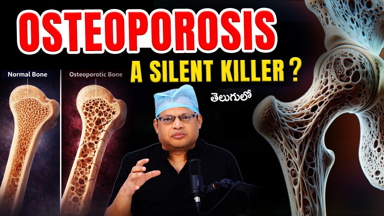 ఆస్టియోపోరోసిస్ అంటే ఏమిటి? ఎందుకు ప్రమాదకరం? | Is osteoporosis a silent killer | Dr GPV Subbaiah