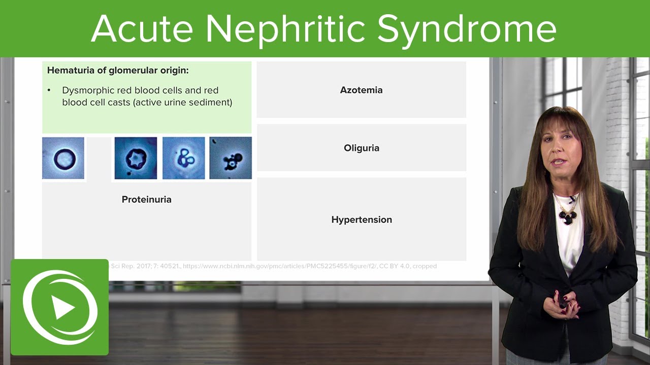 Acute Nephritic Syndrome: Fundamentals &ndash; Nephrotic Syndrome | Lecturio