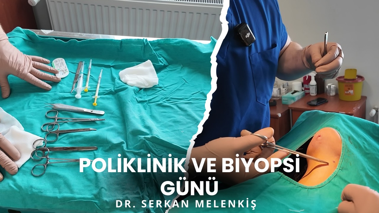 Poliklinik ve Biyopsi Günü