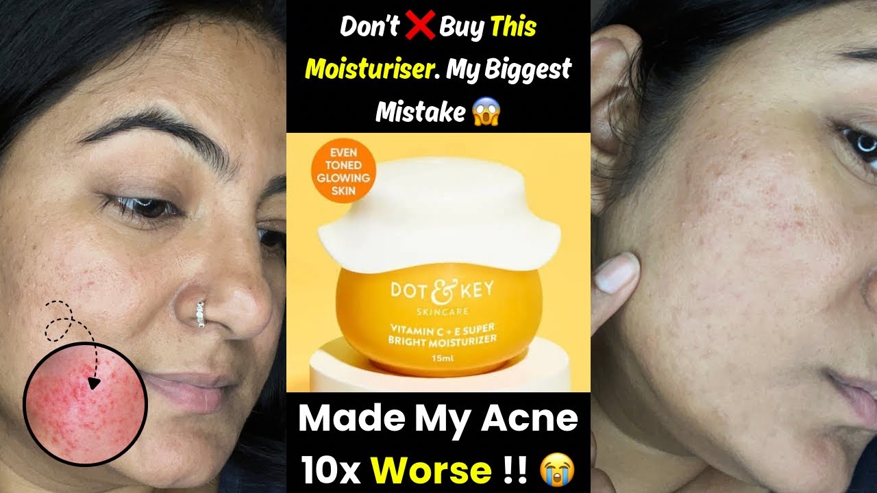 Dot & Key Vitamin C Moisturizer Review | 😡 Biggest Skincare Mistake! | Destroyed My Skin Barrier 😭