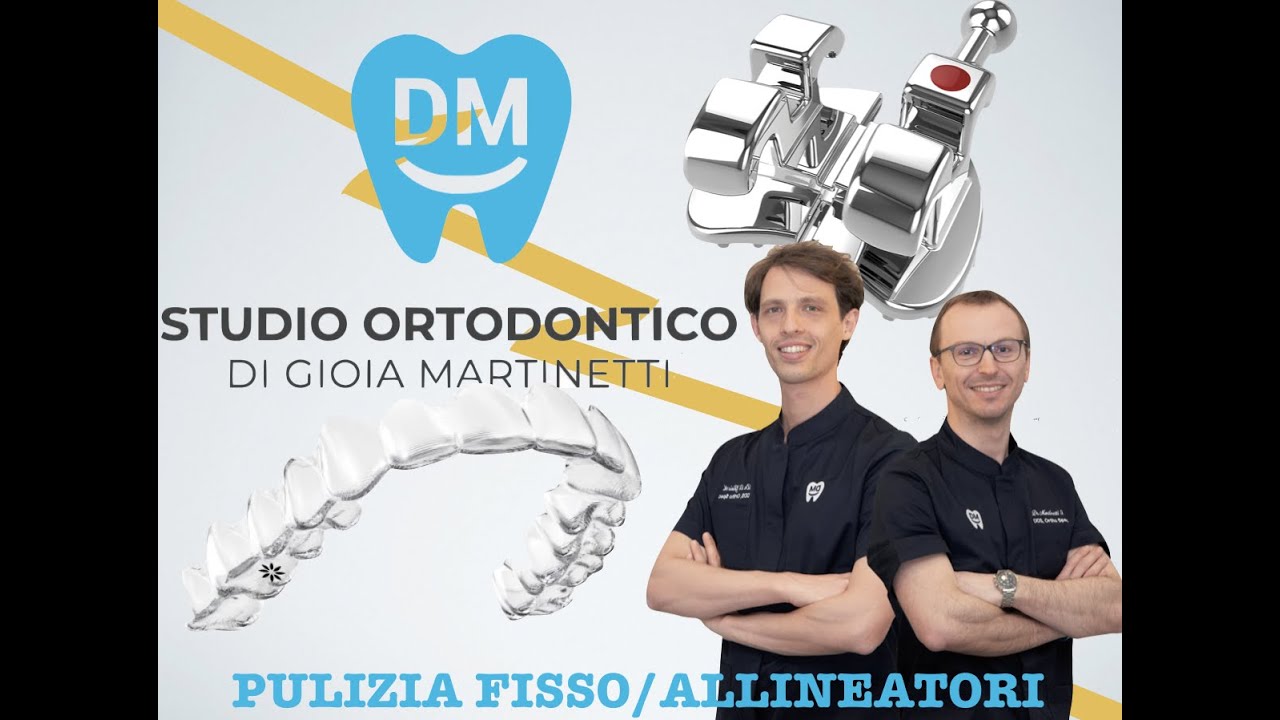 LAVARE I DENTI CON GLI ALLINEATORI e L'APPARECCHIO FISSO, QUAL è PIù FACILE? DI Gioia & Martinetti
