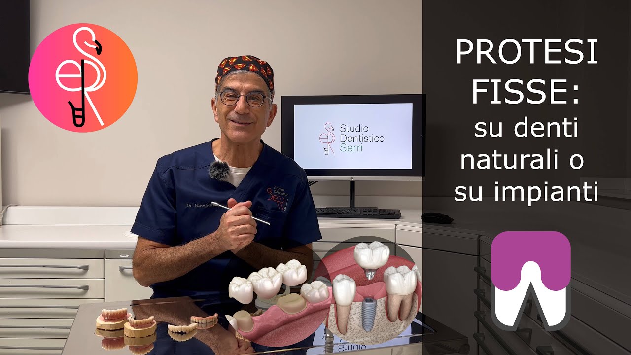 Protesi Fisse : su denti naturali o su impianti?