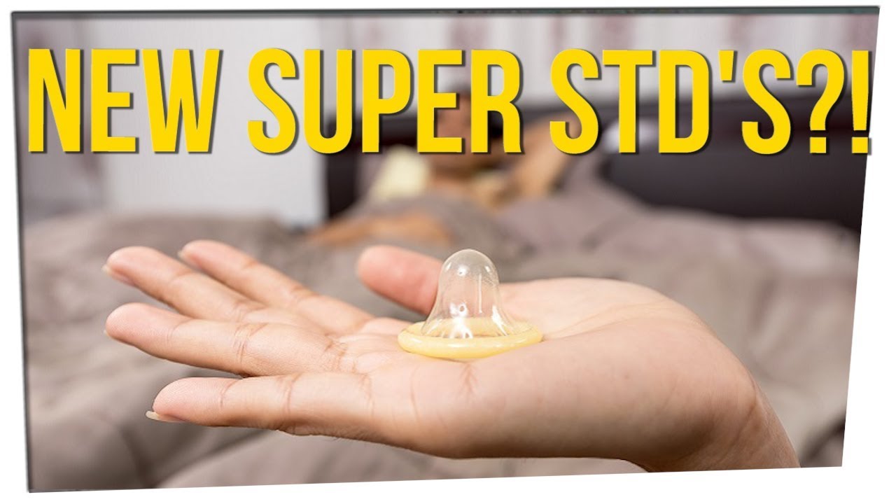 Man Has World’s First Case of ‘Super Gonorrhea’ ft. Jess Lizama & DavidSoComedy
