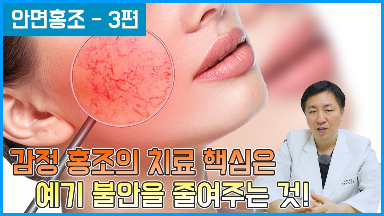 감정홍조 치료의 최종목표는 예기불안을 줄여주는 것 [안면홍조 - 3편]