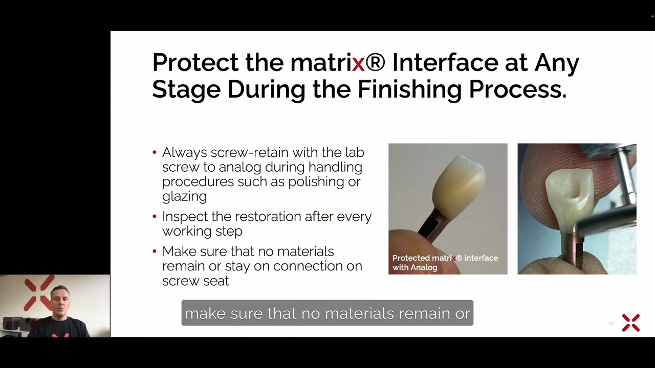 Finishing of matrix® prosthetics | matrix® Digital Academy