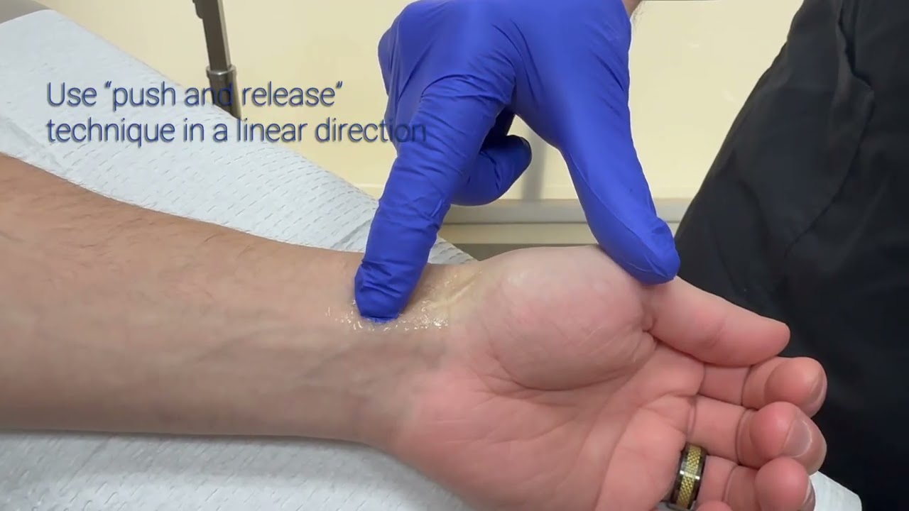 Scar Massage Video