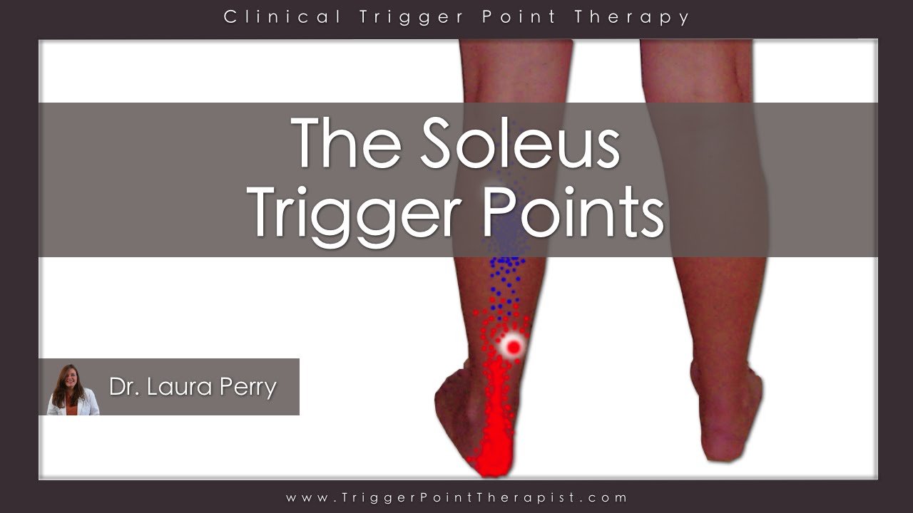 The Soleus Trigger Points