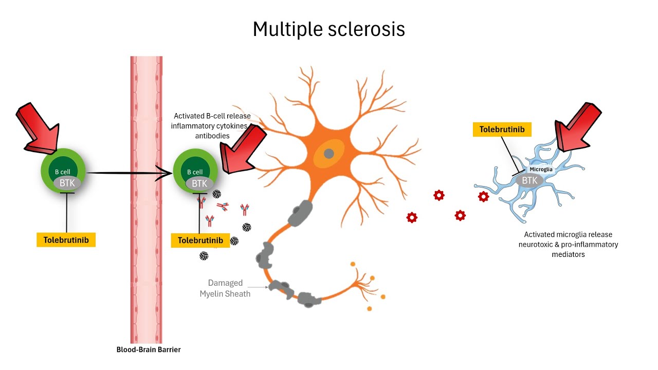 How Tolebrutinib Works | Redefining Multiple Sclerosis Therapy & The Countdown to FDA Approval
