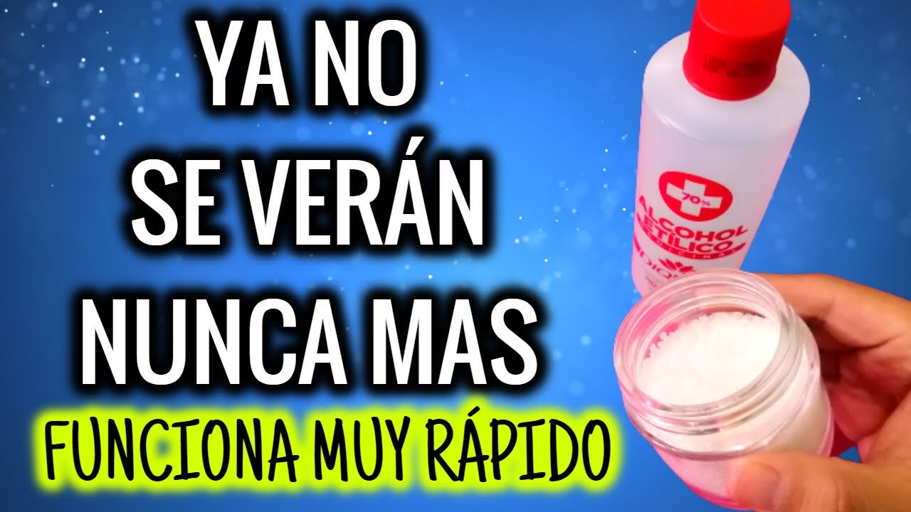 SEP&Aacute;RALOS CON SAL Y ALCOHOL YA NO SE VER&Aacute;N MAS! FUNCIONA MUY R&Aacute;PIDO
