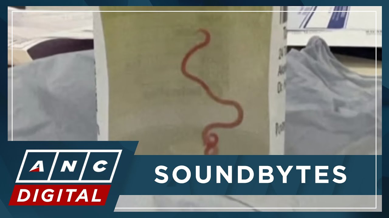 'A big shock': Live worm found in Australian woman's brain in world-first | ANC