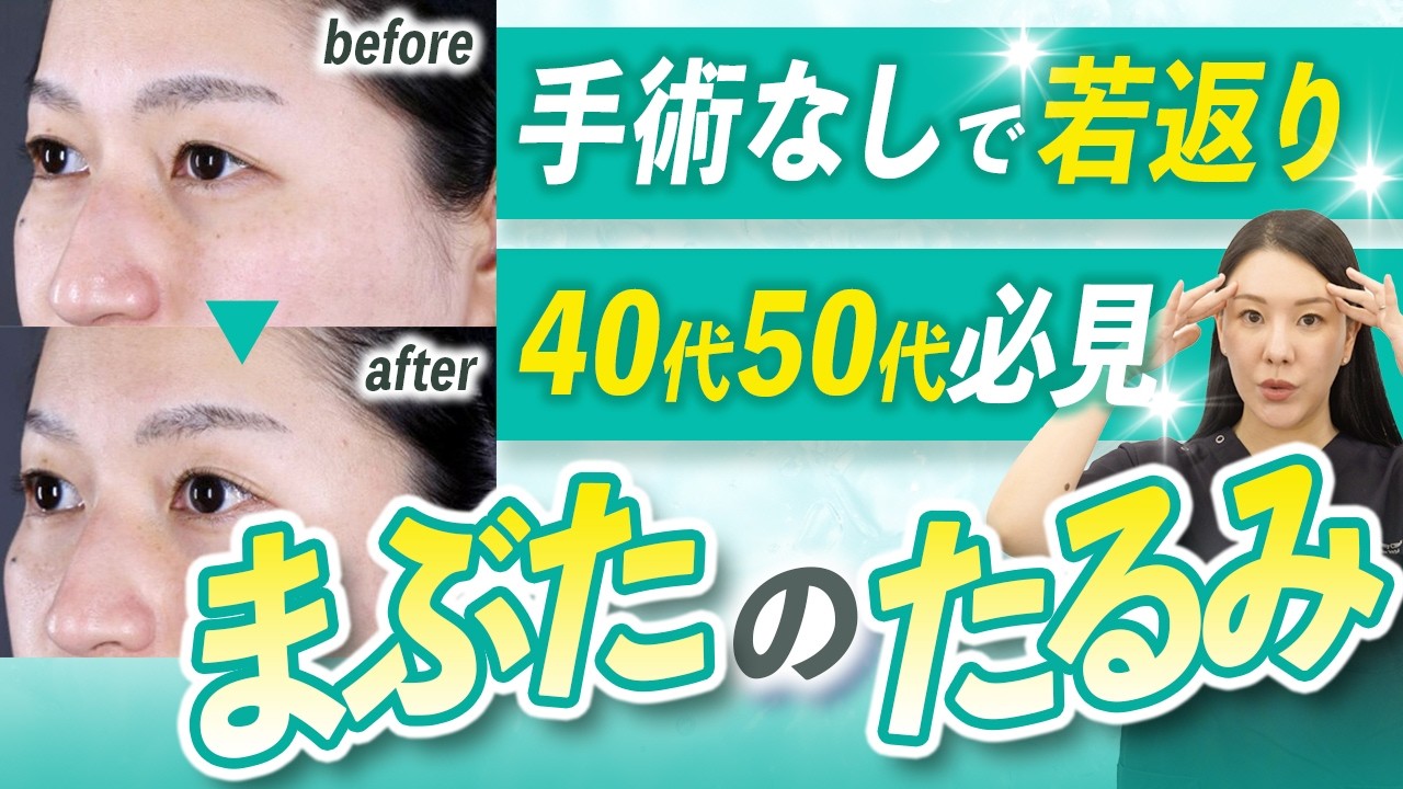 【40代以上必見】西川医師が選ぶおすすめの上まぶたのたるみ治療