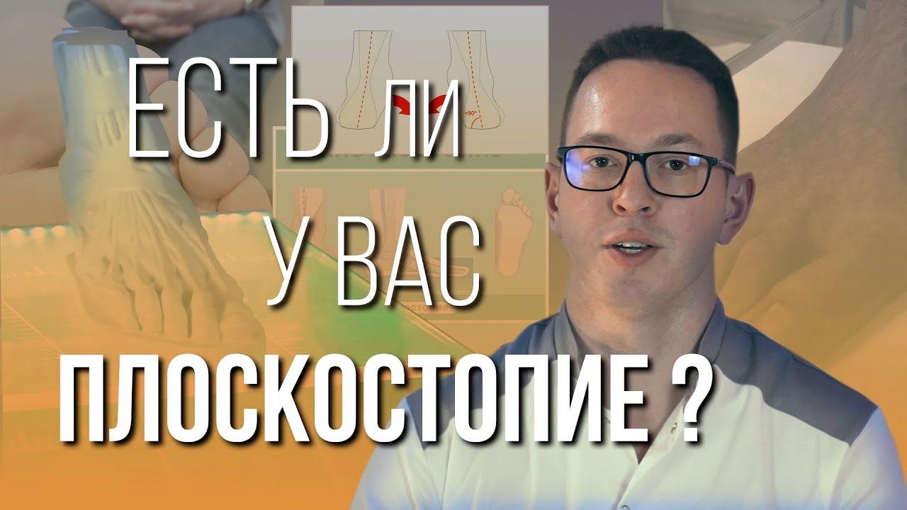 4 признака плоскостопия – как определить самостоятельно