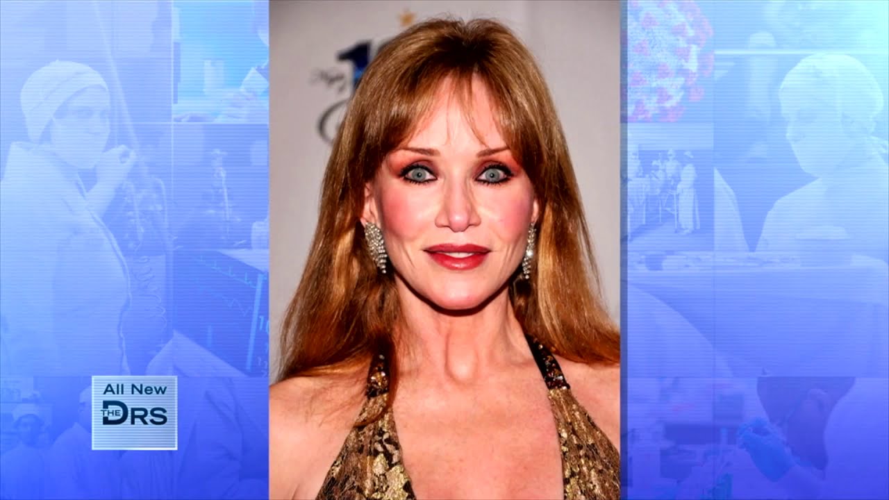 Did Actress Tanya Roberts Lose Her Life to a Urinary Tract Infection?