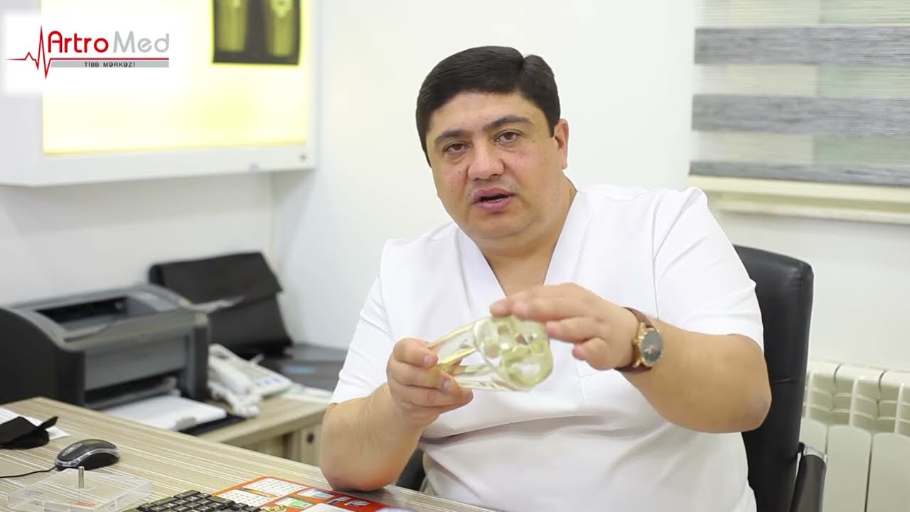 Diz oynağındakı fəsadlar  | Dr. Aqşin Məmmədov