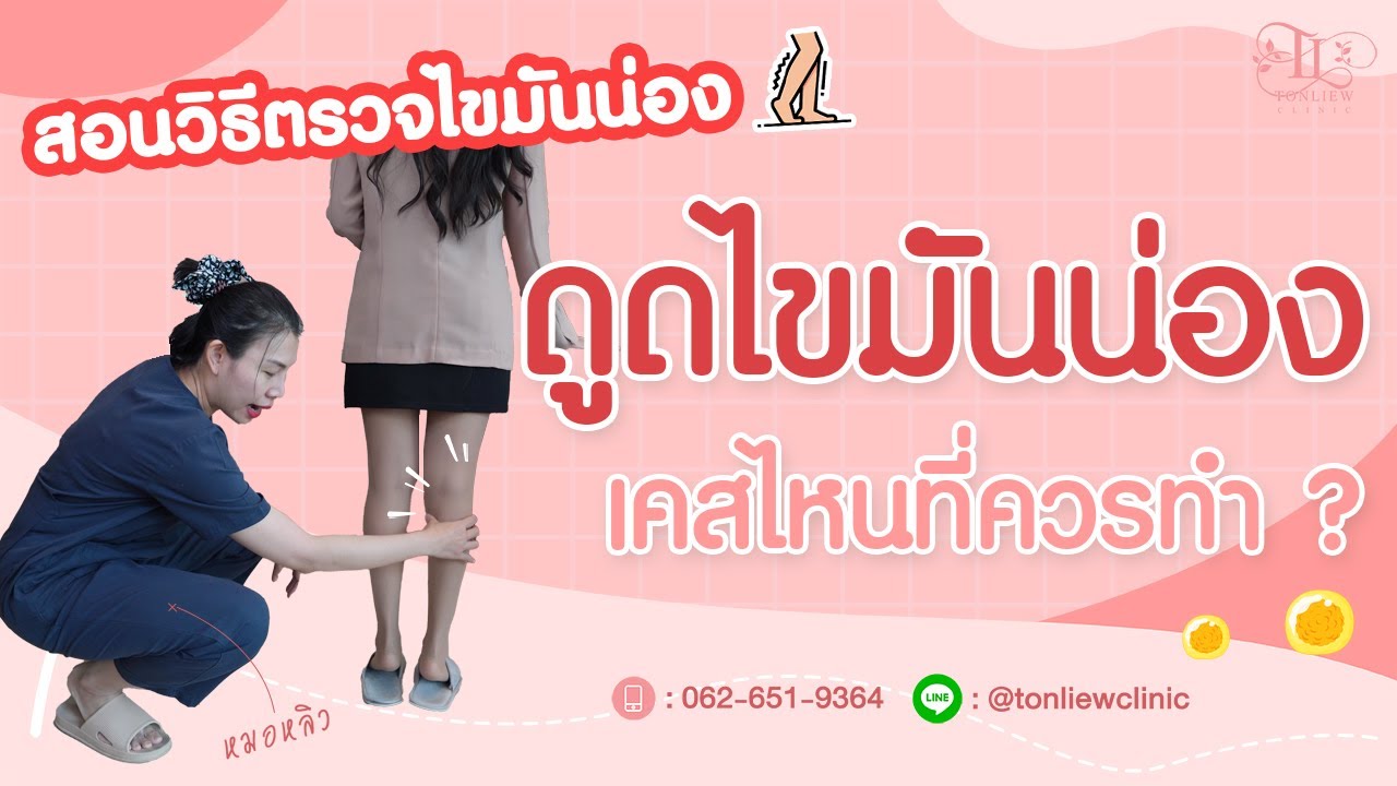 ดูดไขมันน่องขาเรียว คืออะไร ? พร้อมสอนวิธีตรวจไขมันน่อง ด้วยตัวเอง