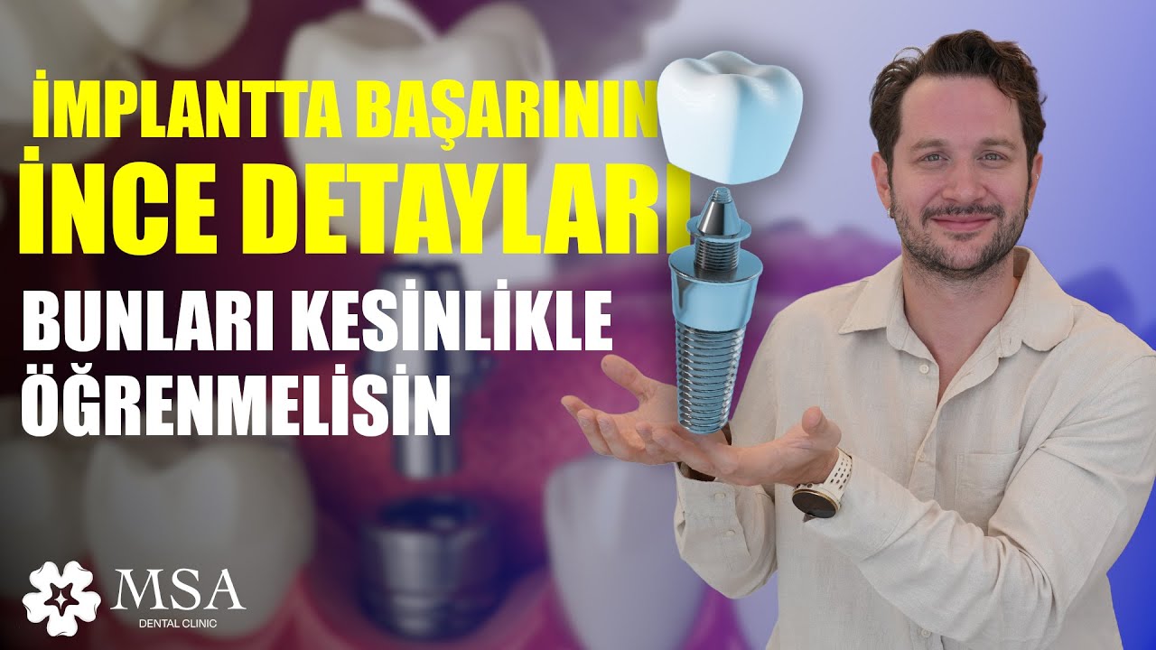 Diş İmplantında Başarının Püf Noktaları - Yaptırmadan Önce Bilmeniz Gerekenler