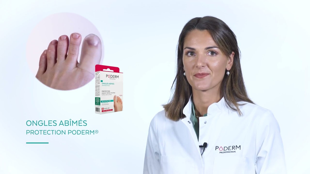 Comment soigner efficacement une Mycose de l'ongle ?