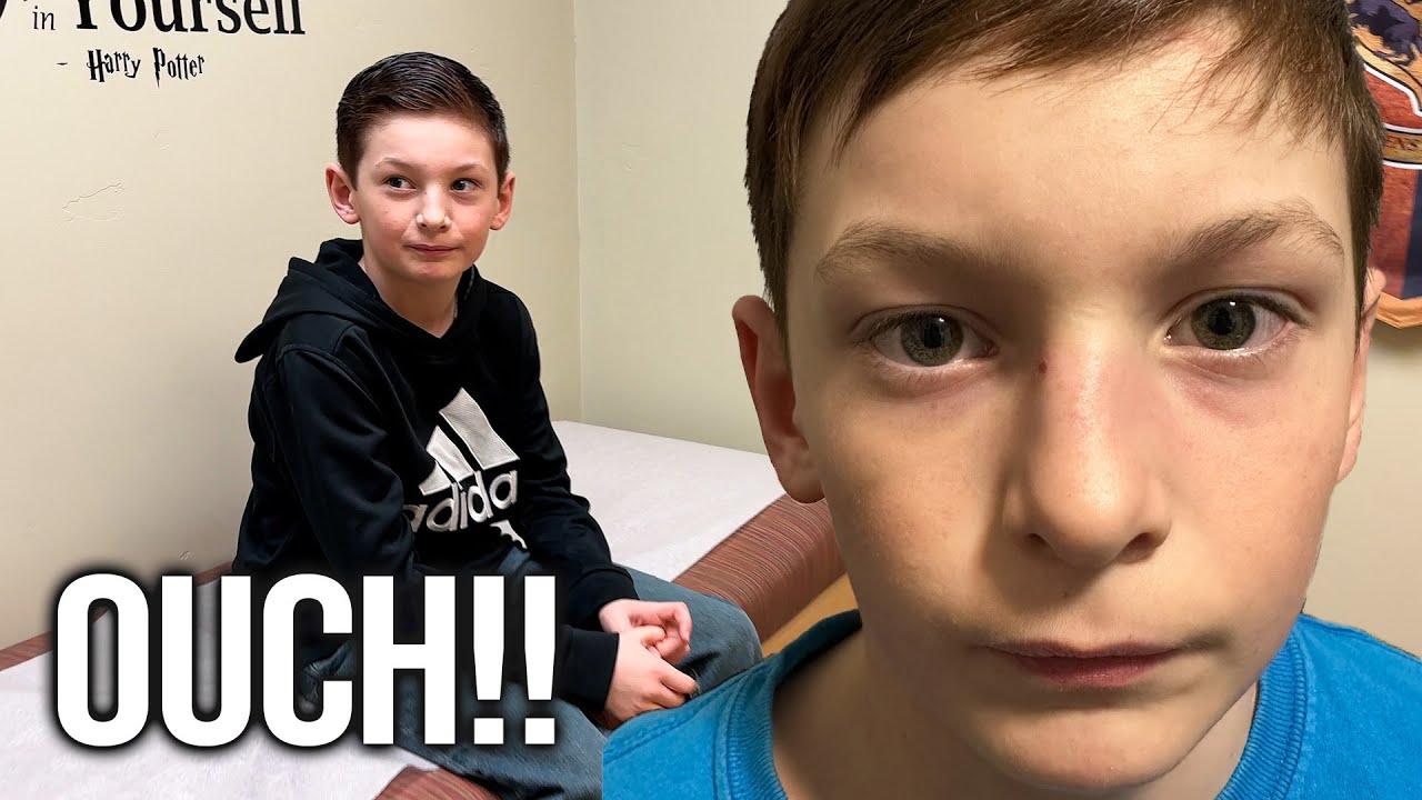 BROKEN NOSE THE WEEK OF WRESTLING STATE? WHAT HAPPENED?