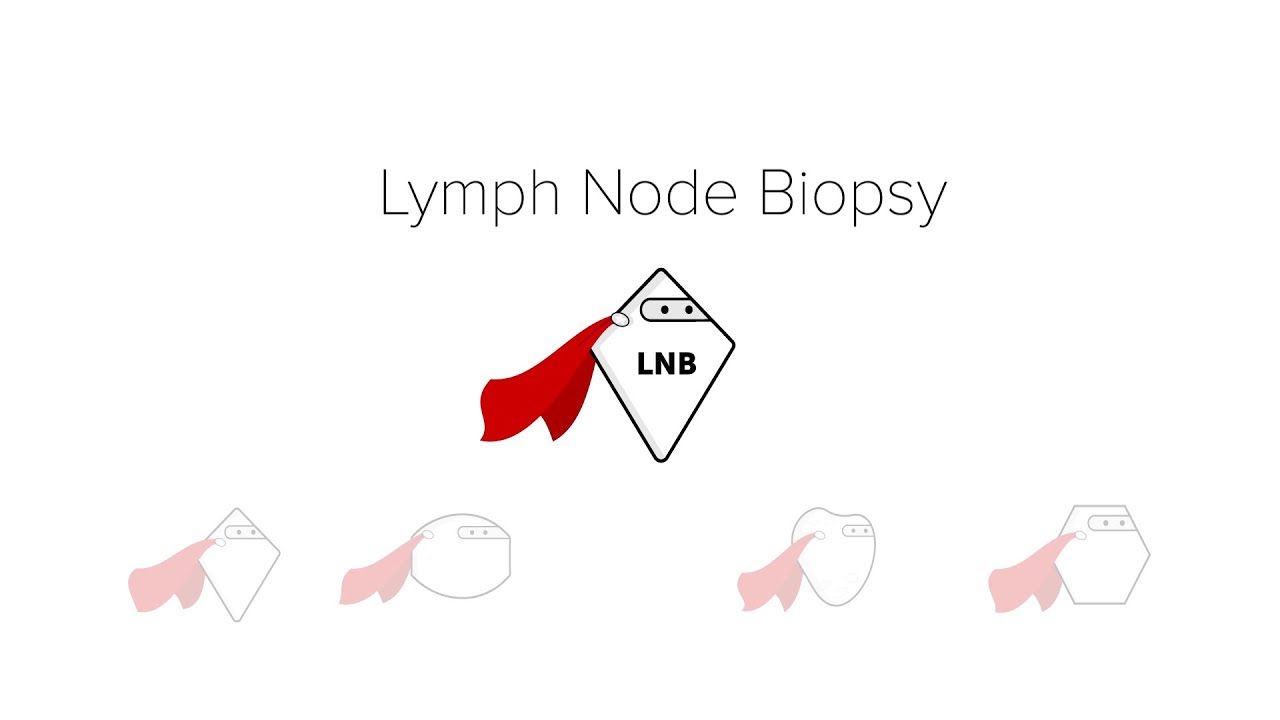 Lymph Node Biopsy