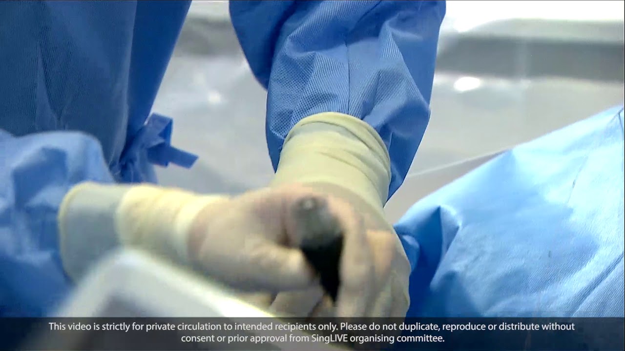 Intravascular Lithotripsy - Singapore LIVE 2020