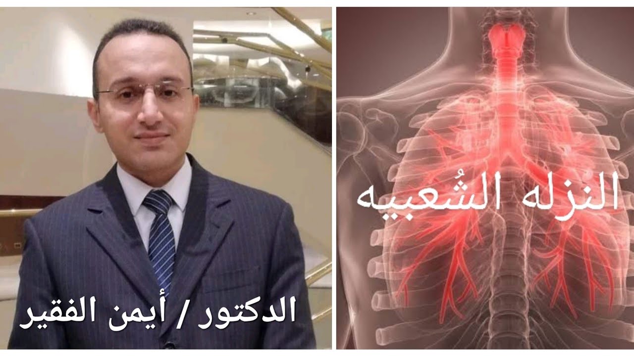 النزله الشُعبيه الحاده ( إلتهاب الشعب  الهوائيه - إلتهاب القصبات الهوائيه - الالتهاب الشُعبي الحاد )