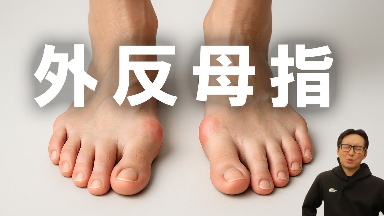 外反母趾の“本当の原因”。バレエと足の関係を科学で解説