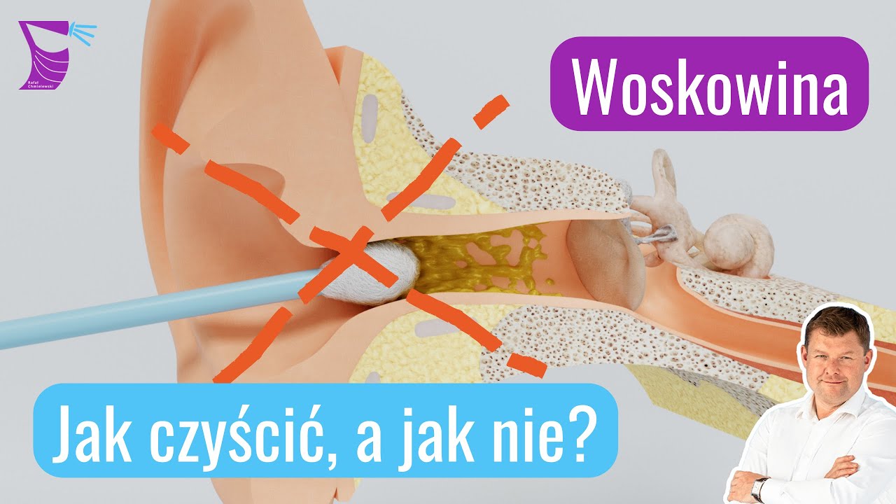 Woskowina &mdash; Jak Czyścić Uszy, a jak Nie?