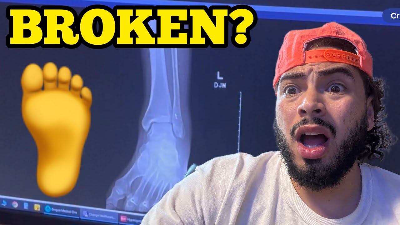 Are The Storage RUMORS TRUE? BROKEN BONES?