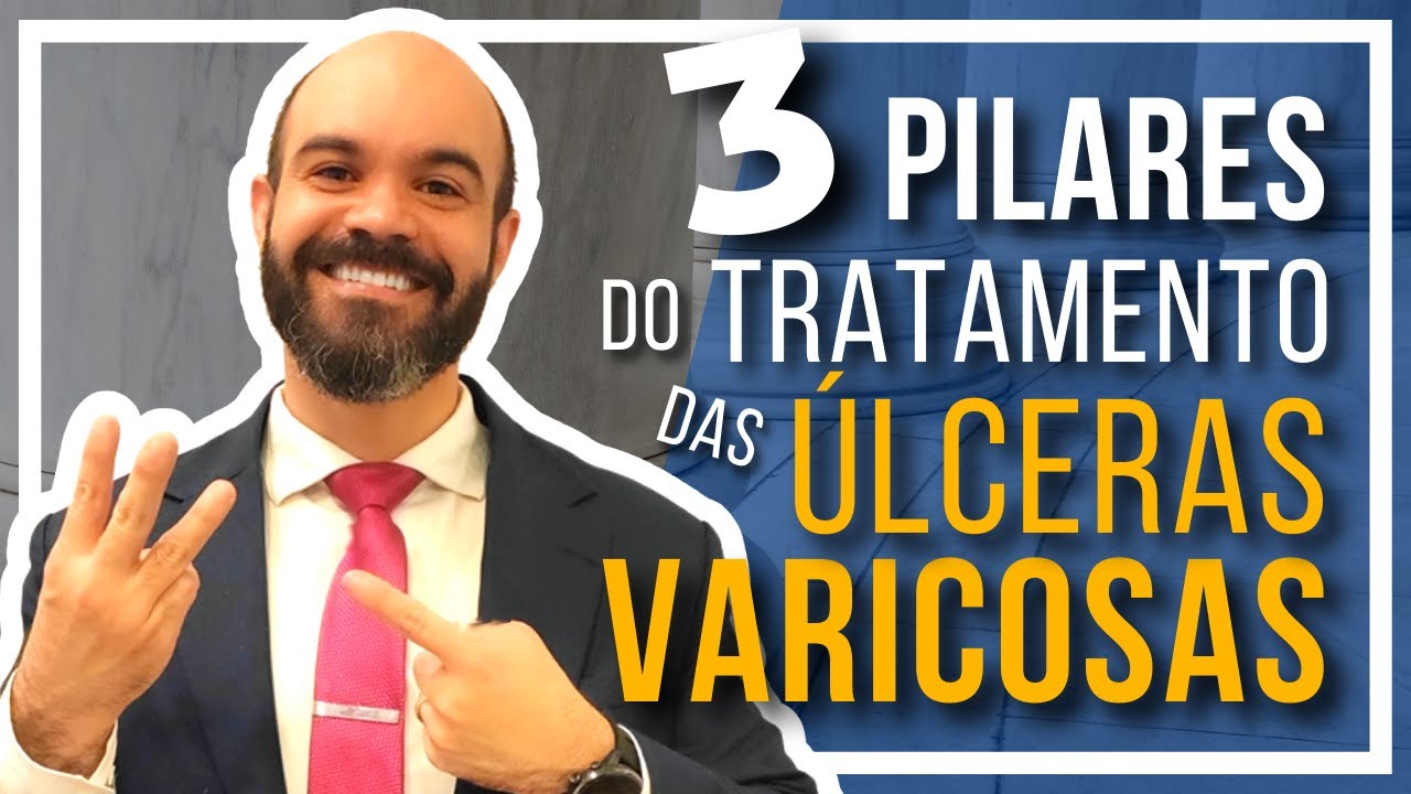 🔴 Os 3 pilares do tratamento das ÚLCERAS VARICOSAS
