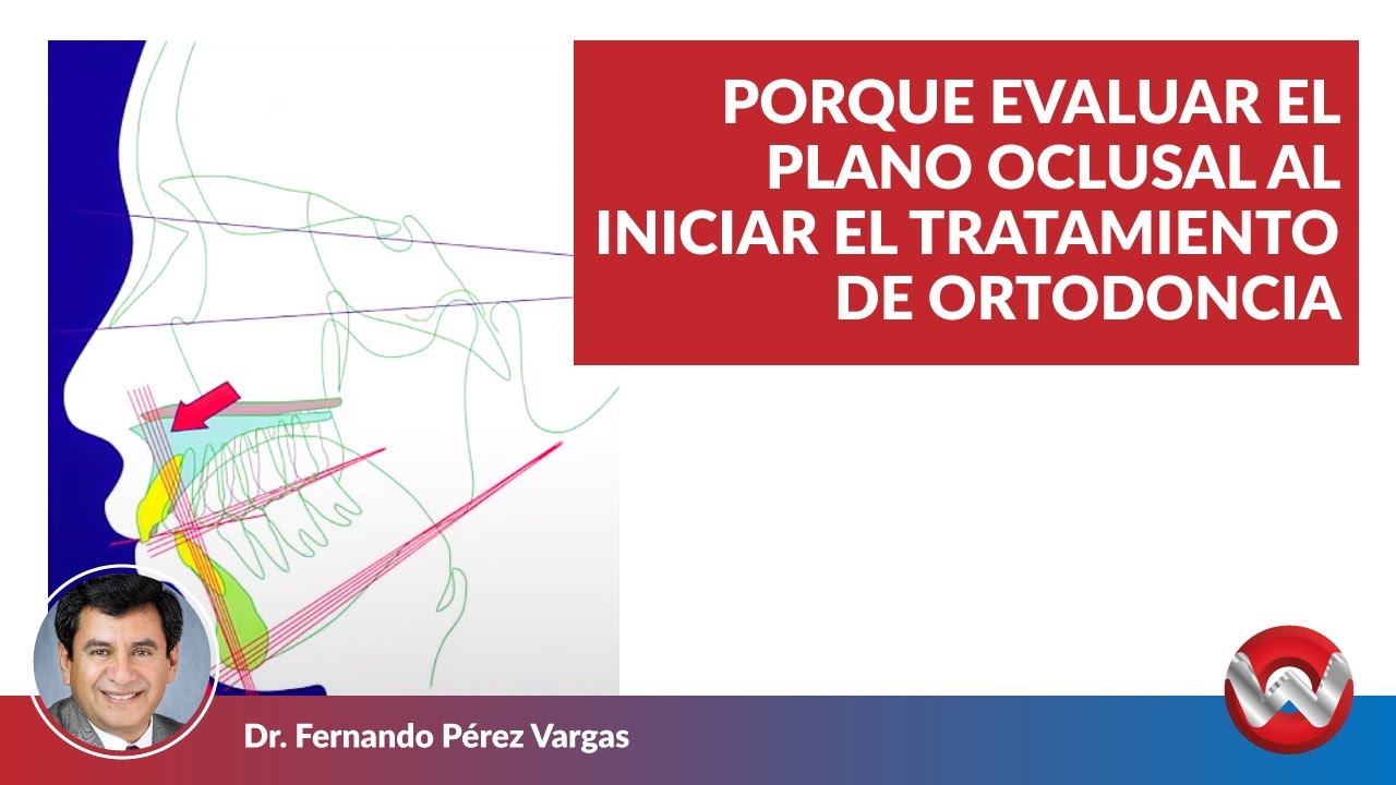 Porque Evaluar el Plano Oclusal al Iniciar el Tratamiento de Ortodoncia