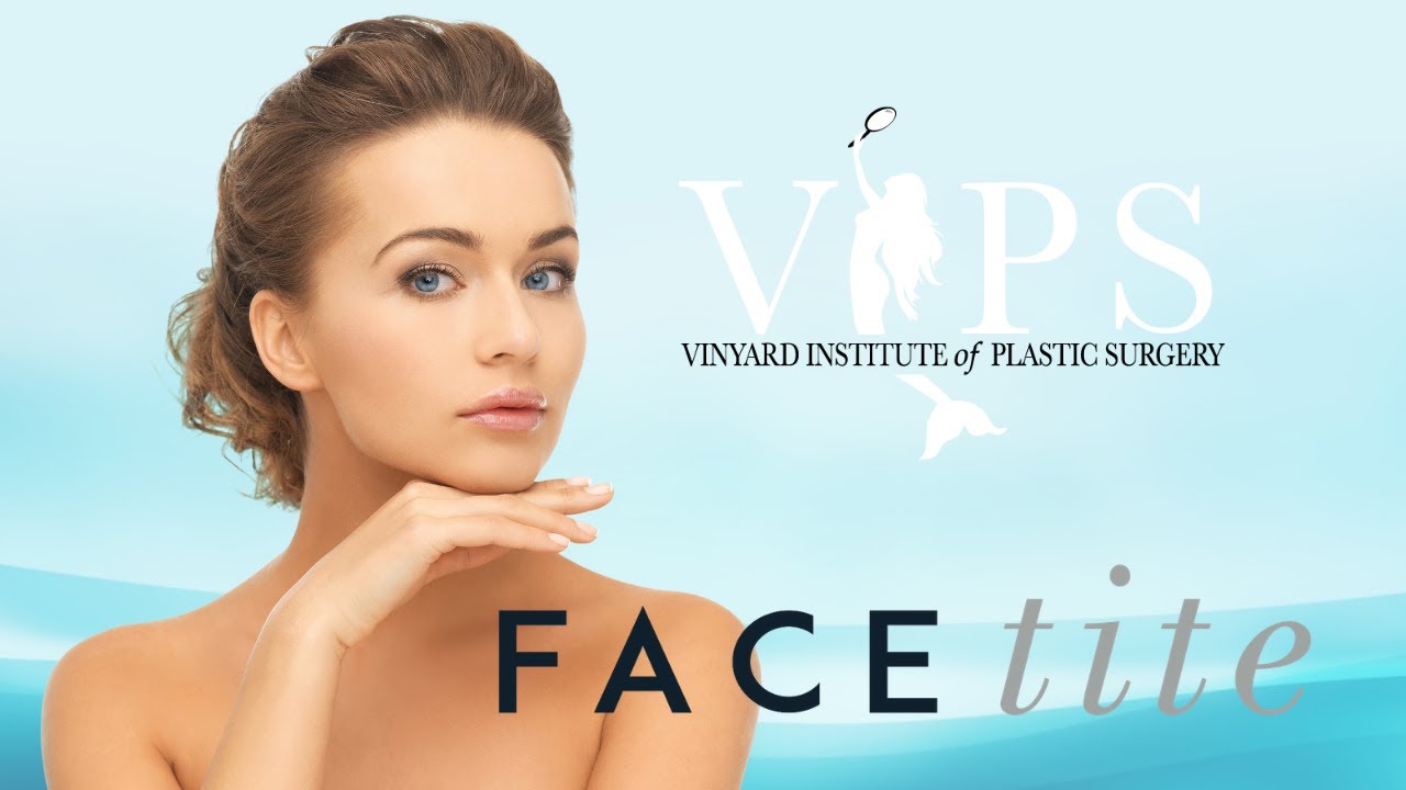 Facetite