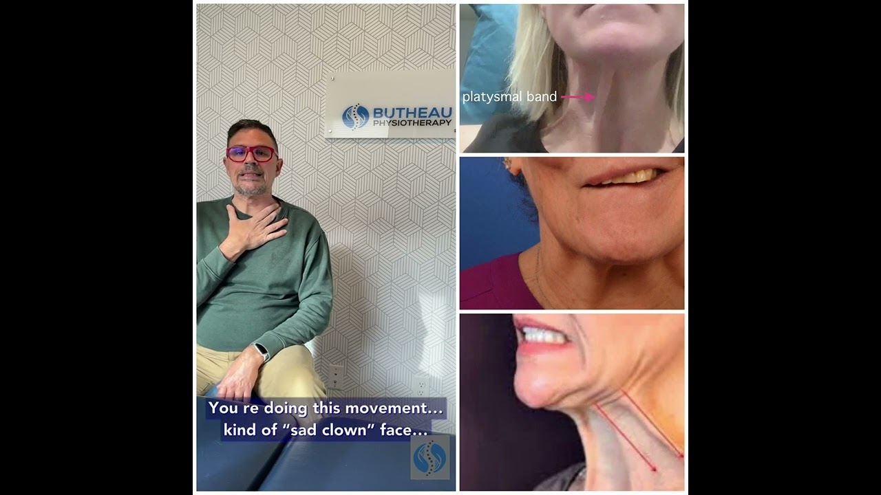 Platysma banding. What it means and what you can do