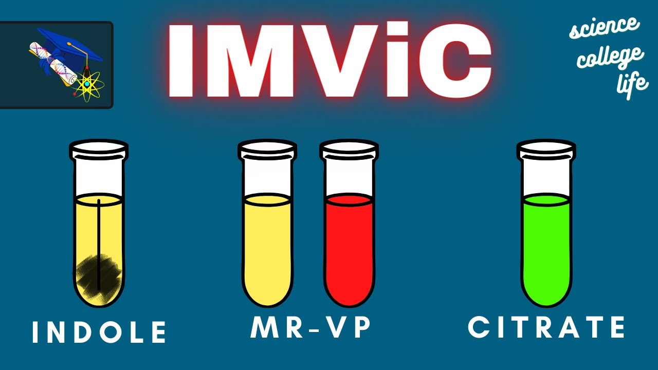 IMViC Test | Indole MR-VP Citrate | Microbiology Lab