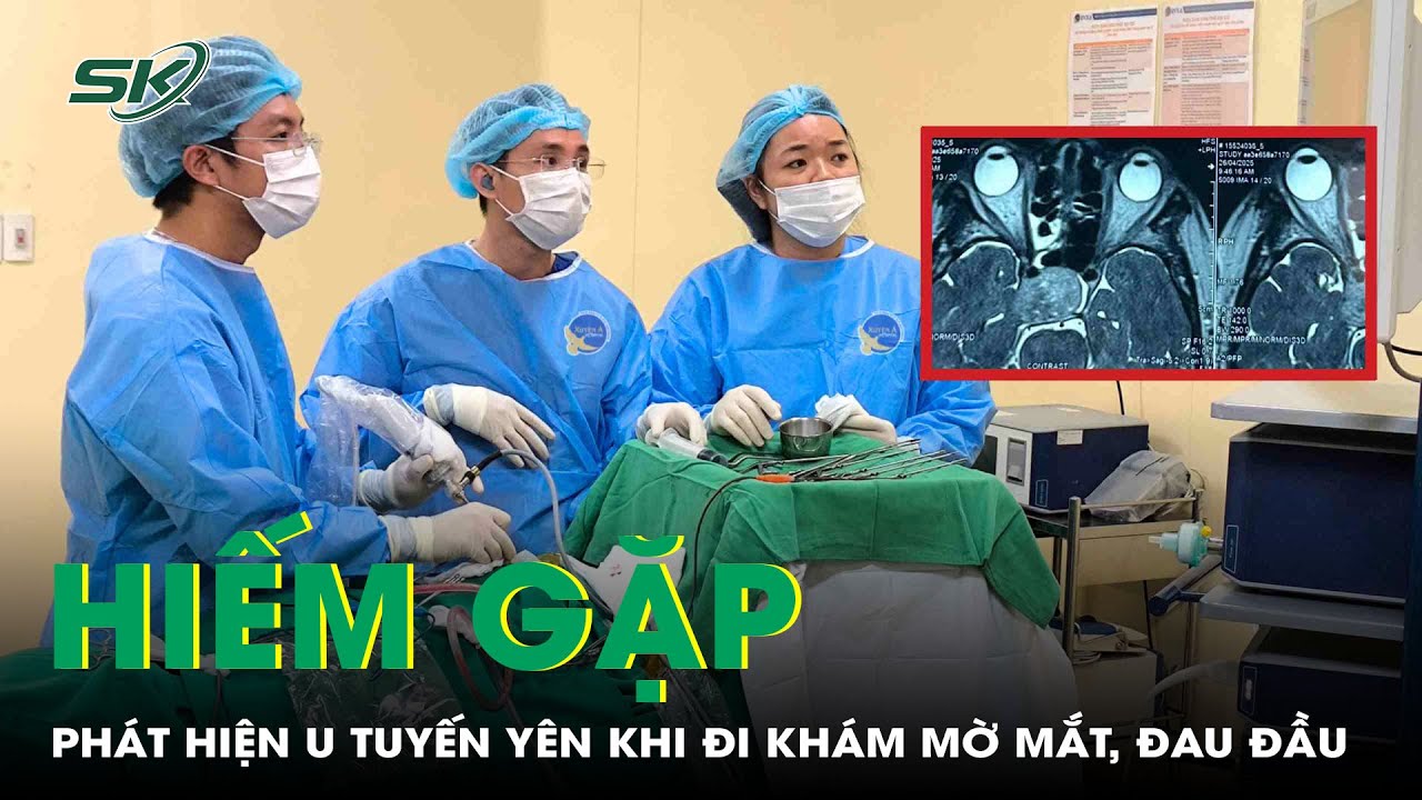 Bất ngờ phát hiện u tuyến yên hiếm gặp chỉ từ dấu hiệu mờ mắt, đau đầu | SKĐS