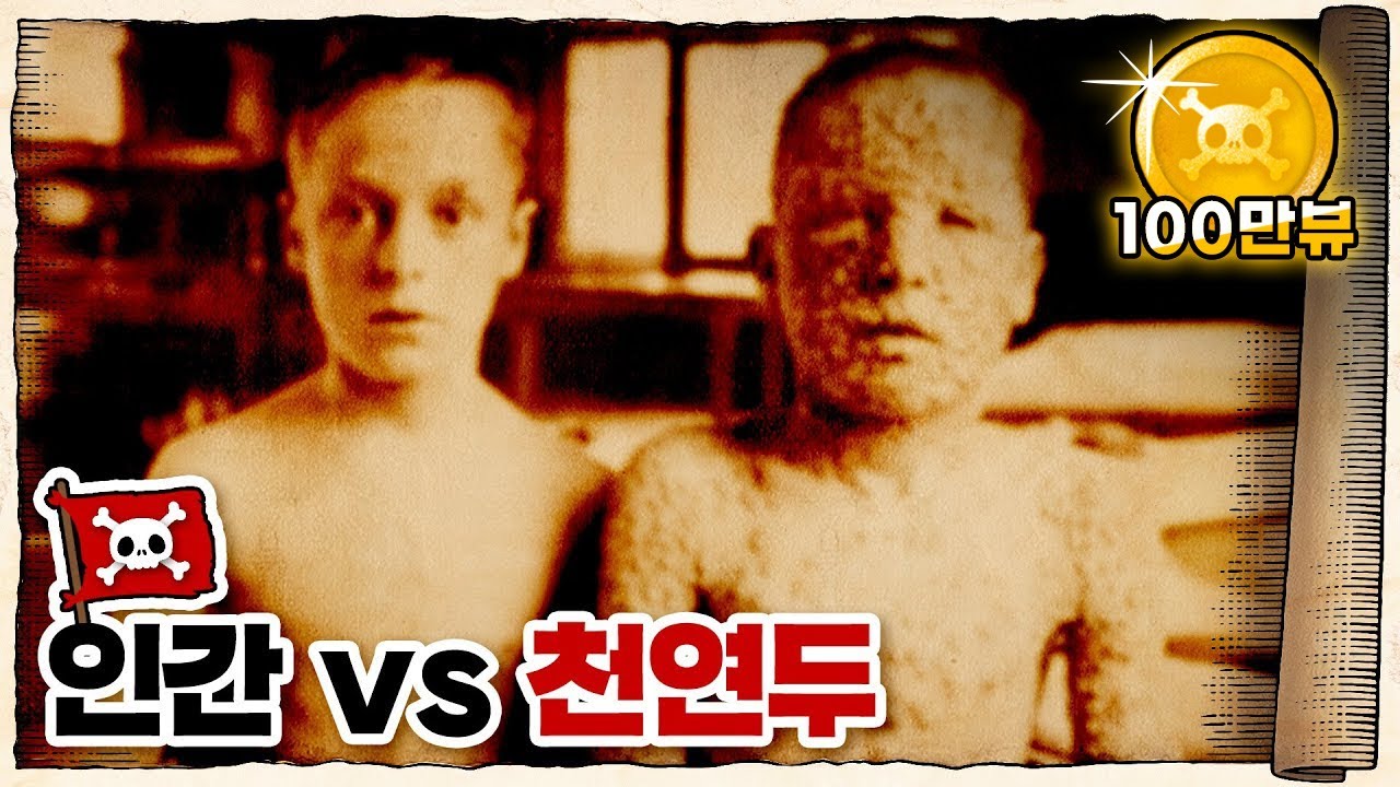 💀 역사상 가장 많은 사람을 죽인... 두창바이러스 / 💀 천연두는 얼마나 무서웠을까?