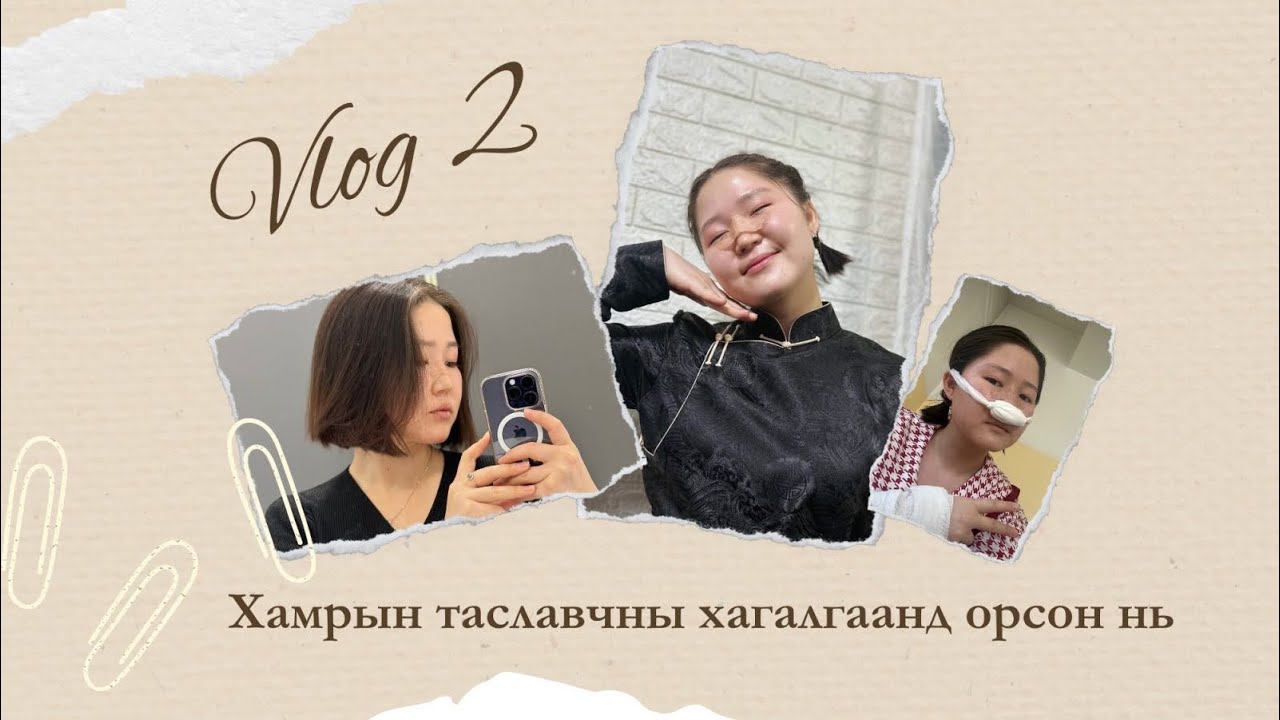 Хамрын таславчны хагалгаанд орсон нь 😓 / Nasal septum surgery /