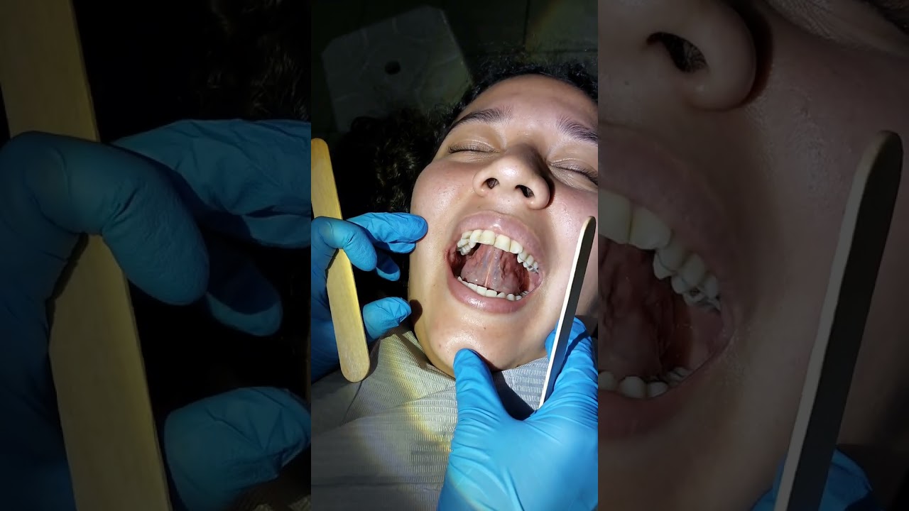 EXAMEN CLÍNICO DEL SISTEMA ESTOMATOGNÁTICO