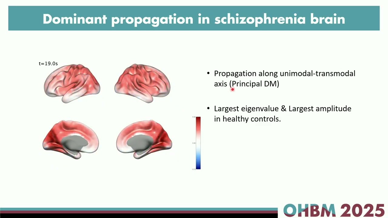 OHBM 2025 | Oral Session | Youngjo Song | Altered Signal Propagation Patterns in the Brains of Ind…